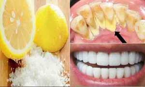  طرق لتبيض الاسنان في المنزل طبيعيا و تحذيرات مهمة