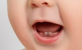 بقع رمادية على أسنان الطفل في الشهر السابع - طبيب دوت كوم
