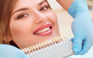 ما هي ميزة تبييض الأسنان بالليزر؟