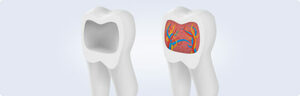 حساسية الأسنان، الأسباب والعلاج